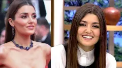 Estetik Faciası mı Yoksa Filtre mi Hande Erçelin Son Paylaşımındaki O Detay Sosyal Medyayı İkiye Böldü Çenesi Yamulmuş - Ucon